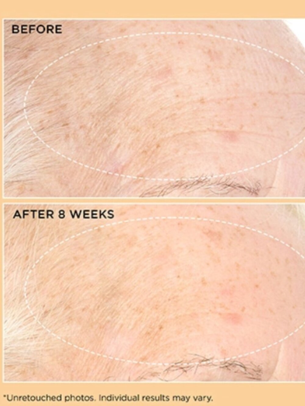 NIB | PERRICONE MD Neuropeptide Pro-Strength Firming Moisturizer Anti-Aging - Picture 8 of 9
